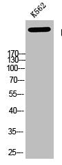 Phospho-ATM (Ser1981) Antibody – Figure 1 of 1