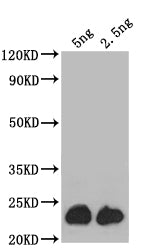 Western Blot
Positive WB detected in: recombinant protein
All lanes: ASPZODRAFT_1728931 Antibody at 1:1000
Secondary
Goat polyclonal to rabbit IgG at 1/50000 dilution
Predicted band size: 24 kDa
Observed band size: 24 kDa