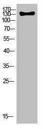Western Blot analysis of HELA cells using Antibody diluted at 500. Secondary antibody  was diluted at 1:20000