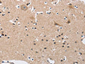 The image on the left is immunohistochemistry of paraffin-embedded Human brain tissue using CSB-PA472830(BUB1 Antibody) at dilution 1/50, on the right is treated with fusion protein. (Original magnification: ×200)