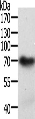 Gel: 10%SDS-PAGE, Lysate: 40 ug, Lane: Mouse brain tissue, Primary antibody: CSB-PA477766(SPDL1 Antibody) at dilution 1/300, Secondary antibody: Goat anti rabbit IgG at 1/8000 dilution, Exposure time: 2 minutes