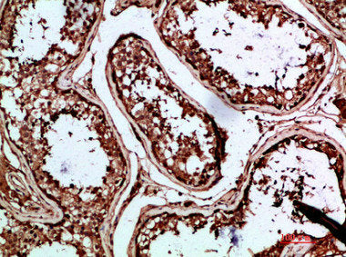 Immunohistochemical analysis of paraffin-embedded human-testis, antibody was diluted at 1:200