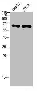 Western Blot analysis of hepg2, NT28 cells using Antibody diluted at 500. Secondary antibody  was diluted at 1:20000
