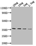 Western BlotPositive WB detected in Recombinant proteinAll lanes: ATG32 antibody at 1:2000SecondaryGoat polyclonal to rabbit IgG at 1/50000 dilutionPredicted band size: 32.8 kDaObserved band size: 35 kDa