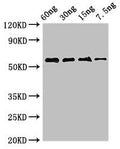 Western Blot
Positive WB detected in Recombinant protein
All lanes: AK antibody at 2.8µg/ml
Secondary
Goat polyclonal to rabbit IgG at 1/50000 dilution
Predicted band size: 55 kDa
Observed band size: 55 kDa