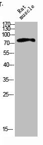Western blot analysis of RAT-MUSLE lysis using IL4R antibody. Antibody was diluted at 1:500. Secondary antibody  was diluted at 1:20000