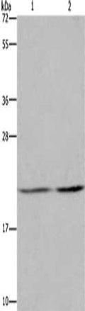 Gel: 8%SDS-PAGE, Lysate: 40 ug, Lane 1-2: A549 cells, Hela cells, Primary antibody: CSB-PA512932(ASF1A Antibody) at dilution 1/1200, Secondary antibody: Goat anti rabbit IgG at 1/8000 dilution, Exposure time: 20 seconds