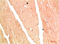 Immunohistochemical analysis of paraffin-embedded Human Skeletal Muslce Tissue using NBR1 Rabbit pAb diluted at 1:200