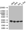 Western Blot
Positive WB detected in: recombinant protein
All lanes: vapB Antibody at 1:1000
Secondary
Goat polyclonal to rabbit IgG at 1/50000 dilution
Predicted band size: 28 kDa
Observed band size: 28 kDa