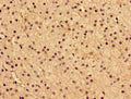 Immunohistochemistry of paraffin-embedded human adrenal gland tissue using CSB-PA516850LA01HU at dilution of 1:100