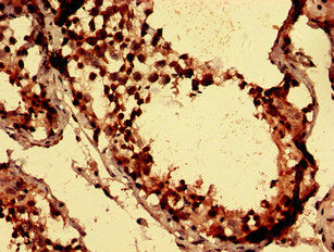 Immunohistochemistry analysis of human testis tissue using CSB-PA517675LA01HU at dilution of 1:100