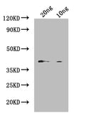 Western Blot
Positive WB detected in: recombinant protein
All lanes: Vitellogenin Antibody at 1:1000
Secondary
Goat polyclonal to rabbit IgG at 1/50000 dilution
Predicted band size: 45 kDa
Observed band size: 45 kDa