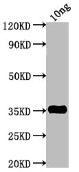 Western Blot
Positive WB detected in Recombinant protein
All lanes: TNF antibody at 1:2000
Secondary
Goat polyclonal to rabbit IgG at 1/50000 dilution
Predicted band size: 34.2 kDa
Observed band size: 35 kDa