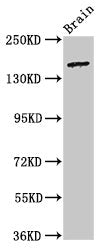 Western Blot
Positive WB detected in: Rat brain tissue
All lanes: ADGRB2 antibody at 3.2ug/ml
Secondary
Goat polyclonal to rabbit IgG at 1/50000 dilution
Predicted band size: 173, 172, 170 kDa
Observed band size: 173 kDa