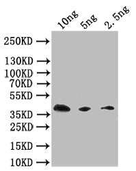Western Blot
Positive WB detected in: recombinant protein
All lanes: Extracellular calcium-sensing receptor  Antibody at 1:1000
Secondary
Goat polyclonal to rabbit IgG at 1/50000 dilution
Predicted band size: 38 kDa
Observed band size: 38 kDa