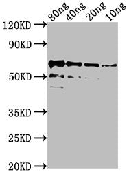Western Blot
Positive WB detected in Recombinant protein
All lanes: algL antibody at 1:2000
Secondary
Goat polyclonal to rabbit IgG at 1/50000 dilution
Predicted band size: 62 kDa
Observed band size: 62 kDa