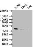 Western Blot
Positive WB detected in: recombinant protein
All lanes: ARGK Antibody at 1:1000
Secondary
Goat polyclonal to rabbit IgG at 1/50000 dilution
Predicted band size: 44 kDa
Observed band size: 44 kDa