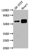Western Blot
Positive WB detected in: SH-SY5Y whole cell lysate, Mouse heart tissue
All lanes: JRK antibody at 1:1000
Secondary
Goat polyclonal to rabbit IgG at 1/50000 dilution
Predicted band size: 62, 63 kDa
Observed band size: 62 kDa