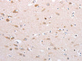 The image on the left is immunohistochemistry of paraffin-embedded Human brain tissue using CSB-PA526117(PFN4 Antibody) at dilution 1/20, on the right is treated with fusion protein. (Original magnification: ×200)