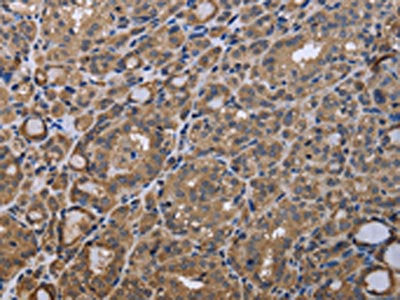 GADD45B Antibody – Figure 1 of 2