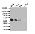 Western Blot
Positive WB detected in: recombinant protein
All lanes: flaB Antibody at 1:1000
Secondary
Goat polyclonal to rabbit IgG at 1/50000 dilution
Predicted band size: 38.8 kDa
Observed band size: 38.8 kDa