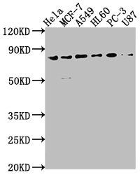 Western Blot
Positive WB detected in: Hela whole cell lysate, MCF-7 whole cell lysate, A549 whole cell lysate, HL60 whole cell lysate, PC-3 whole cell lysate, U87 whole cell lysate
All lanes: EXOC3 antibody at 1:2000
Secondary
Goat polyclonal to rabbit IgG at 1/50000 dilution
Predicted band size: 87, 74, 86 kDa
Observed band size: 87 kDa