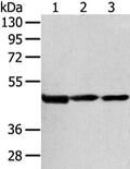 Gel: 8%SDS-PAGE, Lysate: 80 ug, Lane 1-3: Hela cell and human bladder carcinoma tissue, human normal liver tissue, Primary antibody: CSB-PA529469(AGPAT9 Antibody) at dilution 1/200 dilution, Secondary antibody: Goat anti rabbit IgG at 1/8000 dilution, Exposure time: 15 seconds