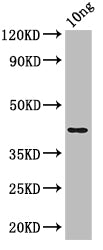 Western Blot
Positive WB detected in: recombinant protein
All lanes: nfuA Antibody at 1:1000
Secondary
Goat polyclonal to rabbit IgG at 1/50000 dilution
Predicted band size: 43 kDa
Observed band size: 43 kDa