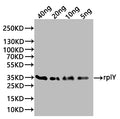 Western Blot
Positive WB detected in: recombinant protein
All lanes:rplY Antibody at 1:1000
Secondary
Goat polyclonal to rabbit IgG at 1/20000 dilution
Predicted band size: 35 kDa
Observed band size: 35 kDa