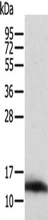 Gel: 12%SDS-PAGE, Lysate: 40 ug, Lane: Jurkat cells, Primary antibody: CSB-PA545326(ACYP1 Antibody) at dilution 1/300, Secondary antibody: Goat anti rabbit IgG at 1/8000 dilution, Exposure time: 10 minutes
