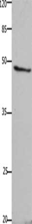 Gel: 10%SDS-PAGE, Lysate: 40 ug, Lane: A549 cells, Primary antibody: CSB-PA545380(GHSR Antibody) at dilution 1/1500, Secondary antibody: Goat anti rabbit IgG at 1/8000 dilution, Exposure time: 1 minute