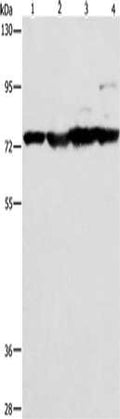 Gel: 8%SDS-PAGE, Lysate: 40 ug, Lane 1-4: Mouse stomach tissue, Mouse heart tissue, Mouse liver tissue, HT29 cells, Primary antibody: CSB-PA545776(MMP15 Antibody) at dilution 1/200, Secondary antibody: Goat anti rabbit IgG at 1/8000 dilution, Exposure time: 1 minute