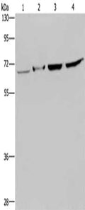 Gel: 8%SDS-PAGE, Lysate: 40 ug, Lane 1-4: Human testis tissue, mouse liver tissue, Hela cells, 293T cells, Primary antibody: CSB-PA546627(HACL1 Antibody) at dilution 1/200, Secondary antibody: Goat anti rabbit IgG at 1/8000 dilution, Exposure time: 5 minutes