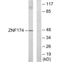 Western blot analysis of extracts from HeLa cells, using ZNF174 antibody.