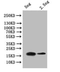 Western Blot
Positive WB detected in: recombinant protein
All lanes:OBP7  Antibody at 1:1000
Secondary
Goat polyclonal to rabbit IgG at 1/50000 dilution
Predicted band size: 19 kDa
Observed band size: 19 kDa