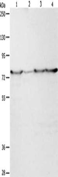 Gel: 8%SDS-PAGE, Lysate: 40 ug, Lane 1-4: Hela cells, human fetal liver tissue, 231 cells, A549 cells, Primary antibody: CSB-PA548387(PEG10 Antibody) at dilution 1/200, Secondary antibody: Goat anti rabbit IgG at 1/8000 dilution, Exposure time: 1 minute