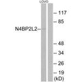 Western blot analysis of extracts from LOVO cells, using N4BP2L2 antibody.
