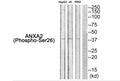 Western blot analysis of extracts from HepG2 cells JK cells and K562 cells using ANXA2 (Phospho-Ser26) Antibody.The lane on the right is treated with the antigen-specific peptide.