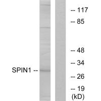 Western blot analysis of extracts from HeLa cells, using SPIN1 antibody.