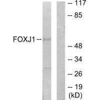 Western blot analysis of extracts from LOVO cells, using FOXJ1 antibody.