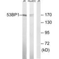 Western blot analysis of extracts from Jurkat cells and HUVEC cells, using 53BP1 (Ab-29) antibody.