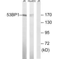 Western blot analysis of extracts from Jurkat cells and HUVEC cells, using 53BP1 (Ab-29) antibody.