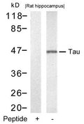 Western blot analysis of extracts from rat hippocampus tissue using Tau(Ab-212) Antibody and the same antibody preincubated with blocking peptide.