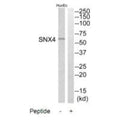 Western blot analysis of extracts from HuvEc cells, using SNX4 antibody.