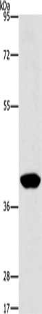 Gel: 8%SDS-PAGE, Lysate: 40 ug, Lane: Human lymphoma tissue, Primary antibody: CSB-PA550806(AGXT2L2 Antibody) at dilution 1/500, Secondary antibody: Goat anti rabbit IgG at 1/8000 dilution, Exposure time: 30 seconds