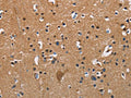 The image on the left is immunohistochemistry of paraffin-embedded Human brain tissue using CSB-PA551448(APOA1 Antibody) at dilution 1/25, on the right is treated with fusion protein. (Original magnification: ×200)