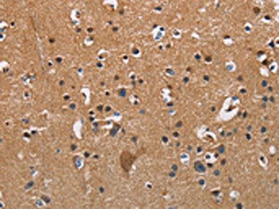 The image on the left is immunohistochemistry of paraffin-embedded Human brain tissue using CSB-PA551448(APOA1 Antibody) at dilution 1/25, on the right is treated with fusion protein. (Original magnification: ×200)