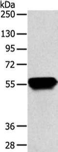 Gel: 8%SDS-PAGE, Lysate: 40 ug, Lane: Hela cell, Primary antibody: CSB-PA552024(KRT4 Antibody) at dilution 1/800 dilution, Secondary antibody: Goat anti rabbit IgG at 1/8000 dilution, Exposure time: 15 seconds