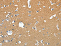 The image on the left is immunohistochemistry of paraffin-embedded Human brain tissue using CSB-PA552452(SSTR4 Antibody) at dilution 1/20, on the right is treated with synthetic peptide. (Original magnification: ×200)