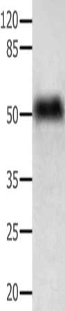 Gel: 10%SDS-PAGE, Lysate: 40 ug, Lane: Mouse liver tissue, Primary antibody: CSB-PA552553(ACPP Antibody) at dilution 1/250, Secondary antibody: Goat anti rabbit IgG at 1/8000 dilution, Exposure time: 10 seconds